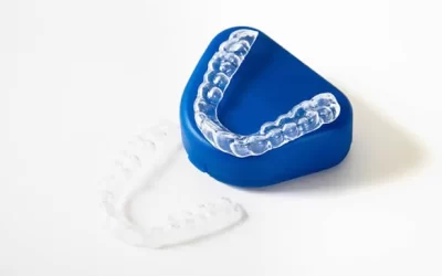Sports and Orthodontics in Mission Hills: Protecting Your Teeth and Jaw During Physical Activity